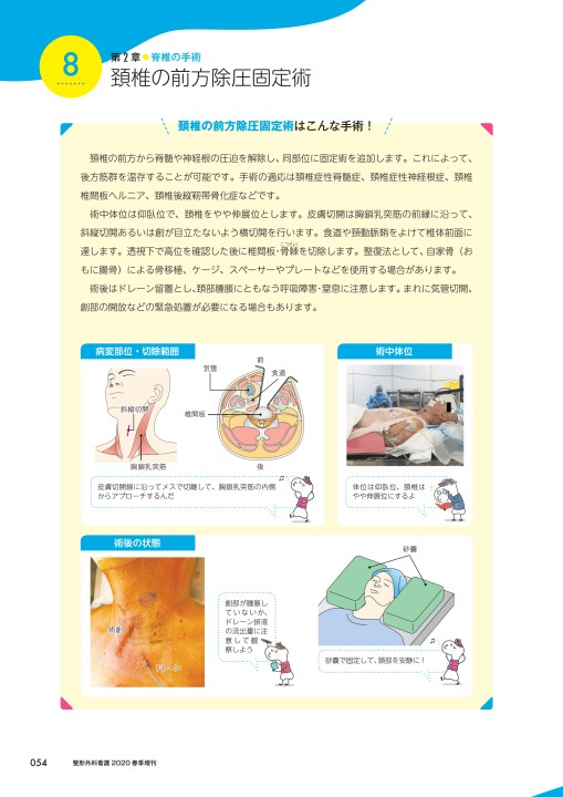 側臥位 手術 体位 腋窩枕 トップ