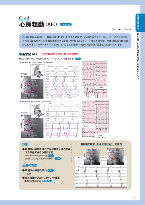 オファー 時計回転通常型 心房粗動